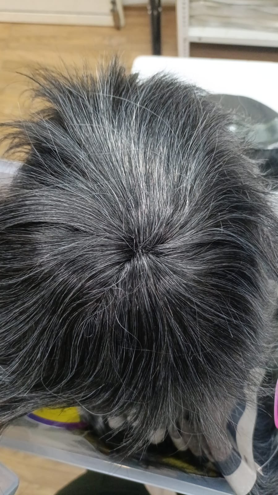 SALT & PEPPER HAIR PATCHES Hair Wig - Image 3