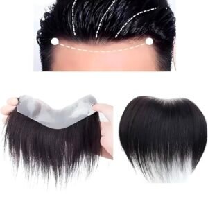 men's frontline hair patches