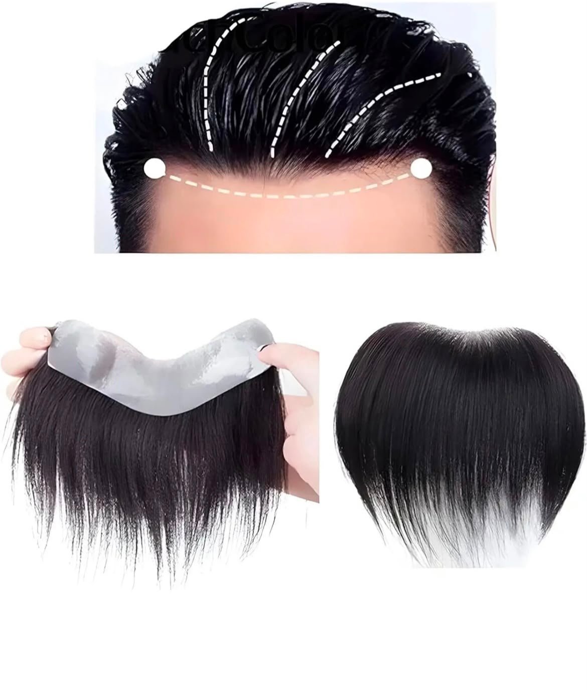 men's frontline hair patches
